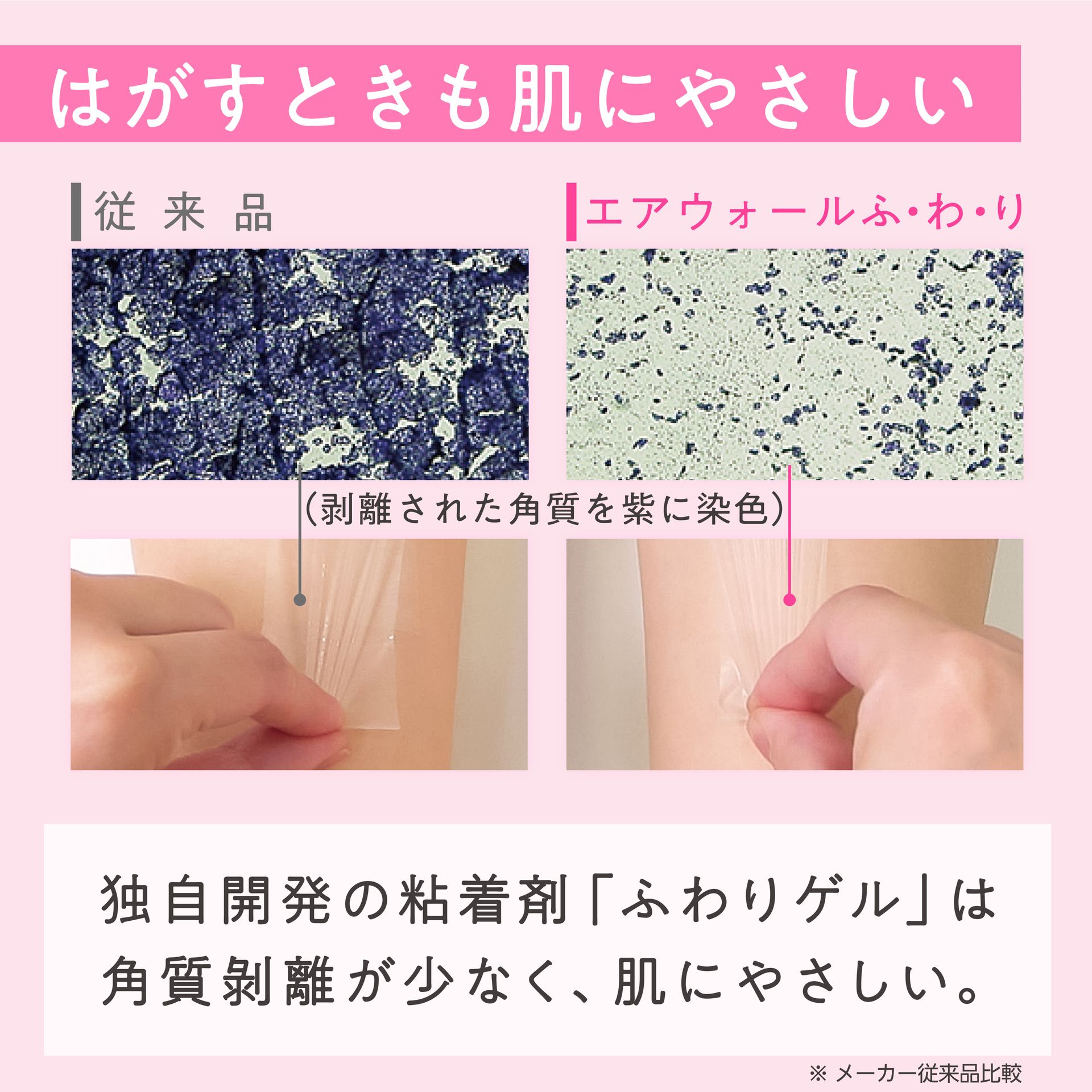 Skinix Air Wall Fuwari 50mm x 5m Ultra Zero Sensory Waterproof Film Roll, Transparent Film Dressing, for Fixing Gauze, Wounds, and Over Bandages, Waterproof Tape, 1 Roll MA-E5050FT
