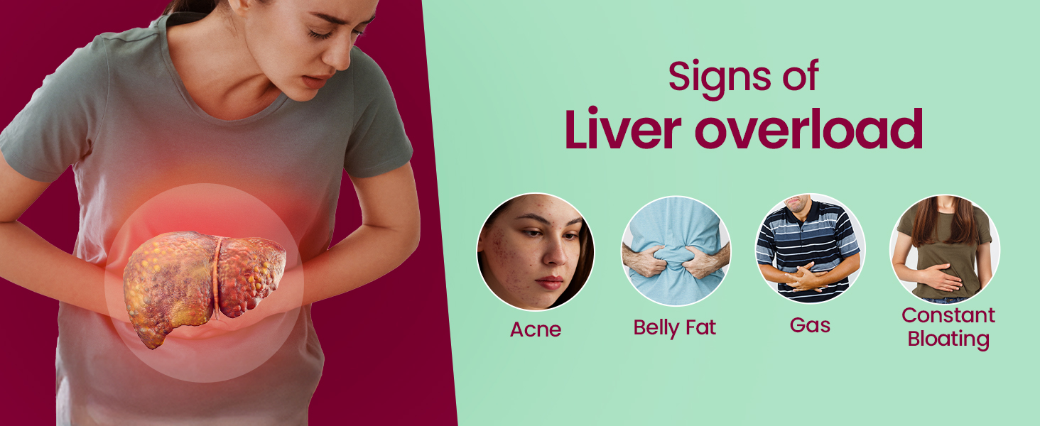 Fast&Up Liver Detox - Daily Liver Cleanser Drink | Milk Thistle + NAC | Helps Improve Digestion & Reduces Load on Liver - 20 Tablets - Mixed Berry Flavour
