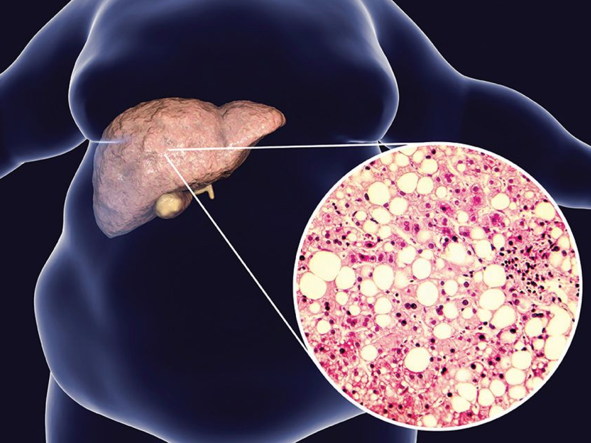 Origins Nutra Liver Restore | Milk Thistle Extract + 5 Active Ingredients