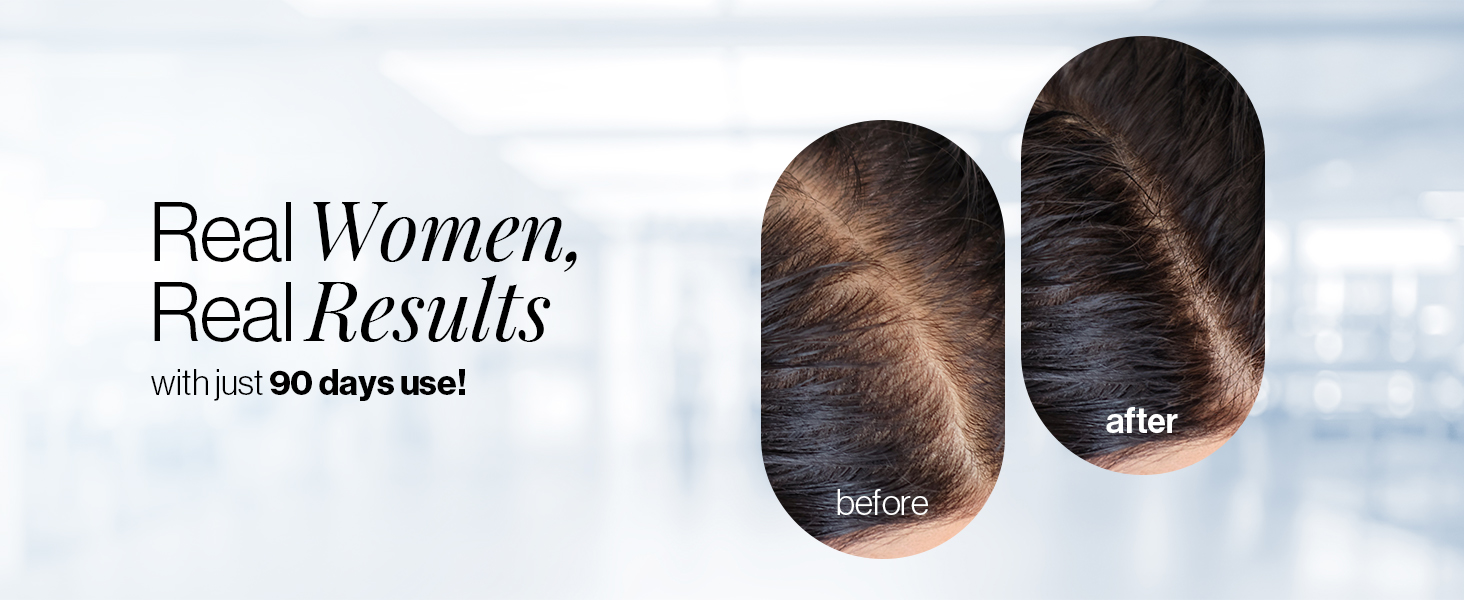 Be Bodywise Biotin Hair Gummies | For Stronger,Shinier Hair & Nails | 120 Day Pack | With Biotin, Zinc, Folic Acid, Fibre & Multivitamin | Strawberry Flavored | No Added Sugar & Gut Friendly