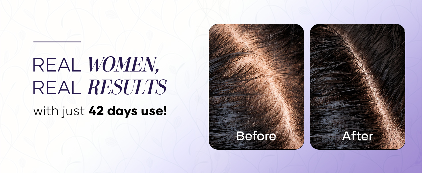 Biotin Capsules for Men and Women | Biotin, Keratin and Collagen Peptides | Supports Healthy Hair, Skin & Nails | Helps Enhance Skin Elasticity & Hydration | Helps in Controlling Wrinkles and Fine Lines | 60 Capsules - Pack of 1 | 30 Days Pack