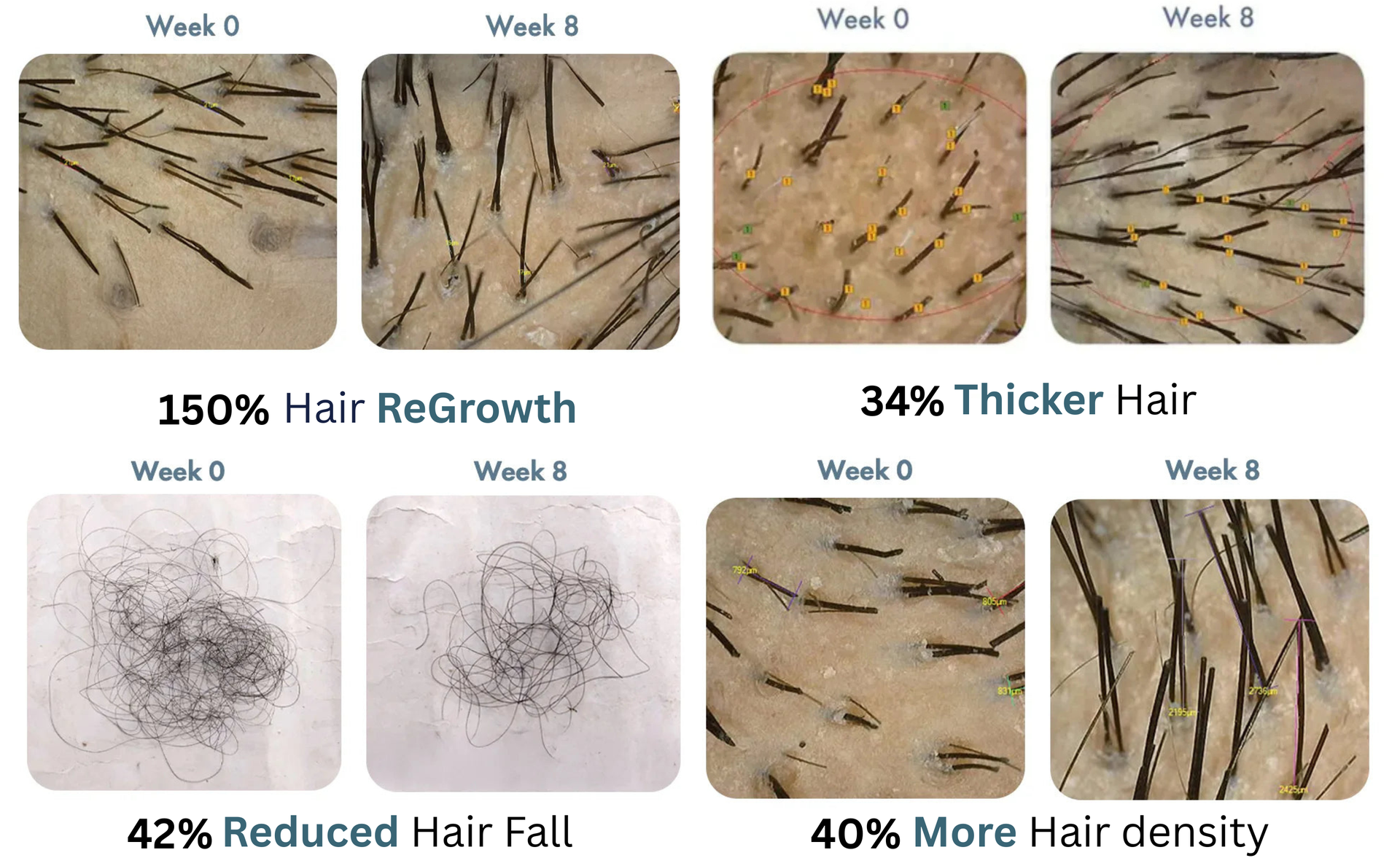 Hair Growth Biotin Tablets | Biotin Tablets with Multivitamin Ingredients