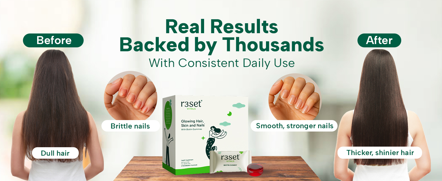 R3SET Biotin Gummies for Hair Growth, Glowing Skin & Nails Support -30 Days