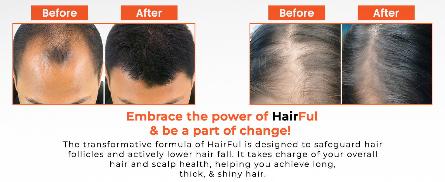 HairFul Hair Multivitamins Healthy Hair Supplement for Better Hair Growth & Hair fall Control (Pack Of 4 X 15) 60 Tablets