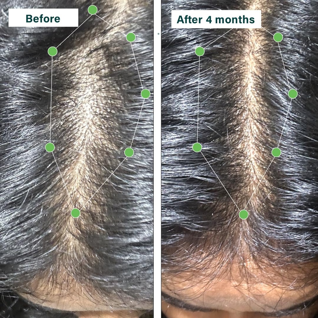oziva-plant-based-hair-vitamins-hair-vit-6.jpg
