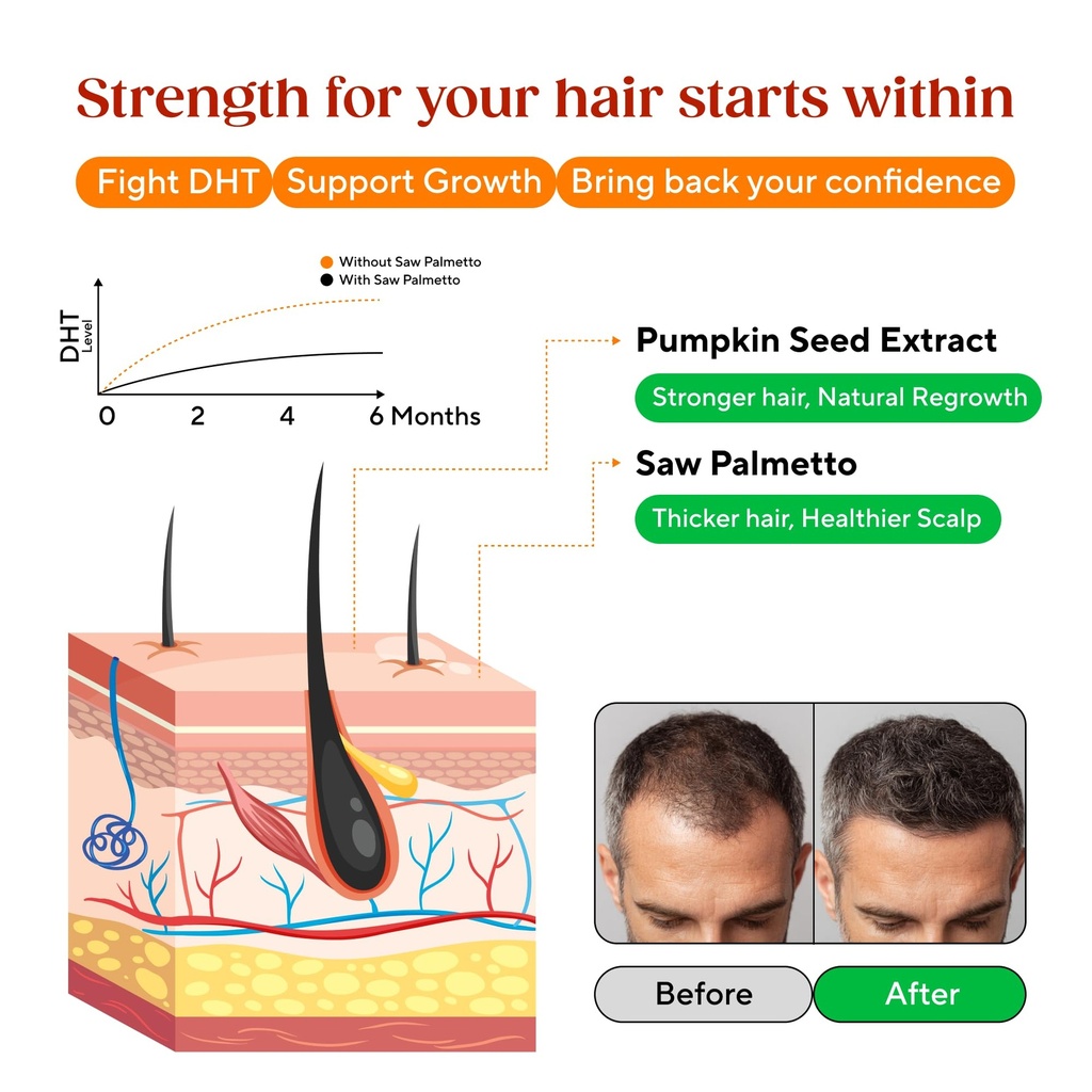 saw-palmetto-gummies-for-hair-growth-hor-3.jpg