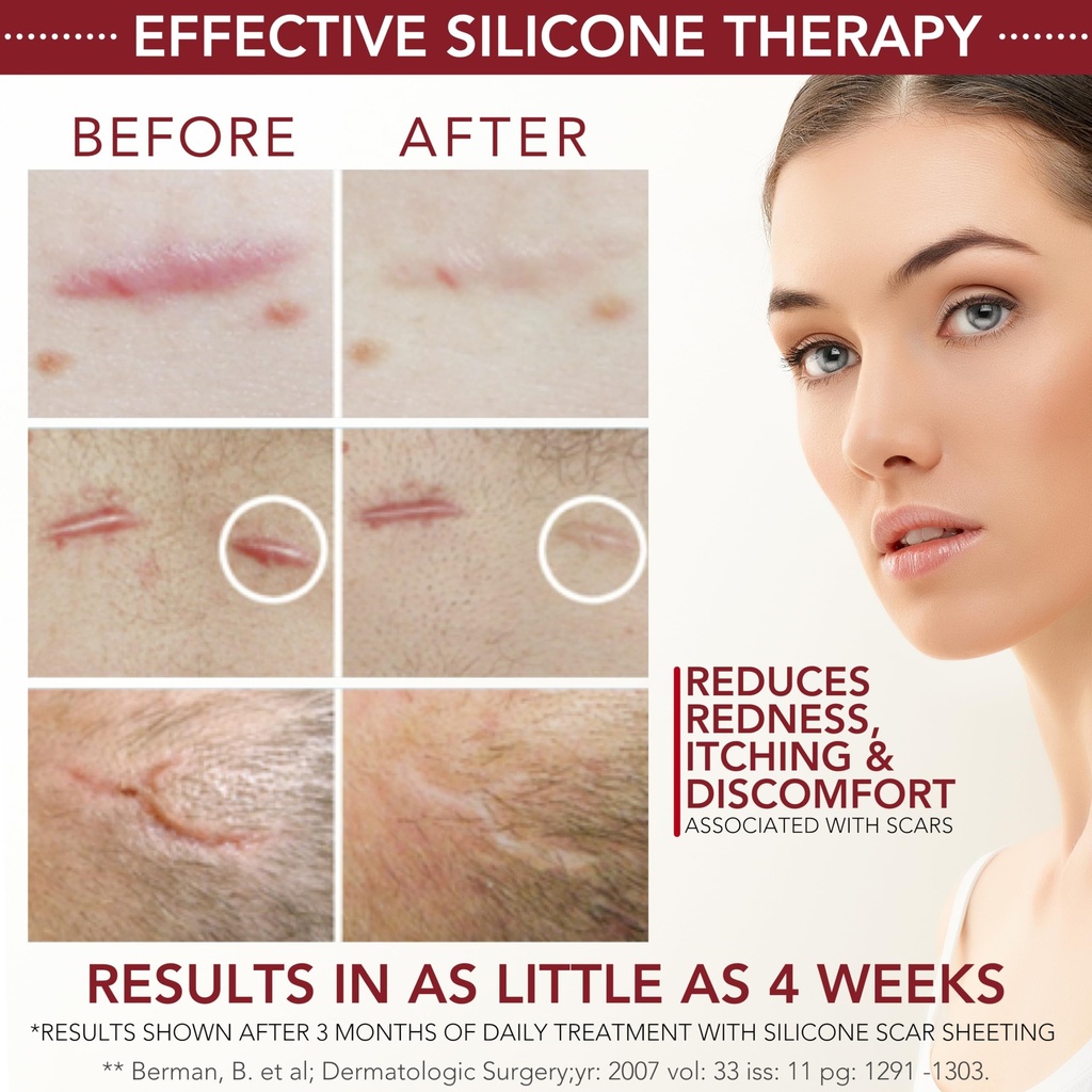 healfast-silicone-scar-gel-cream-for-sur-4.jpg