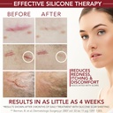 healfast-silicone-scar-gel-cream-for-sur-4.jpg