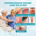 dimora-calcium-alginate-wound-dressing-4-2.jpg