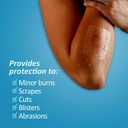 nexcare-tegaderm-transparent-dressing-cl-2.jpg