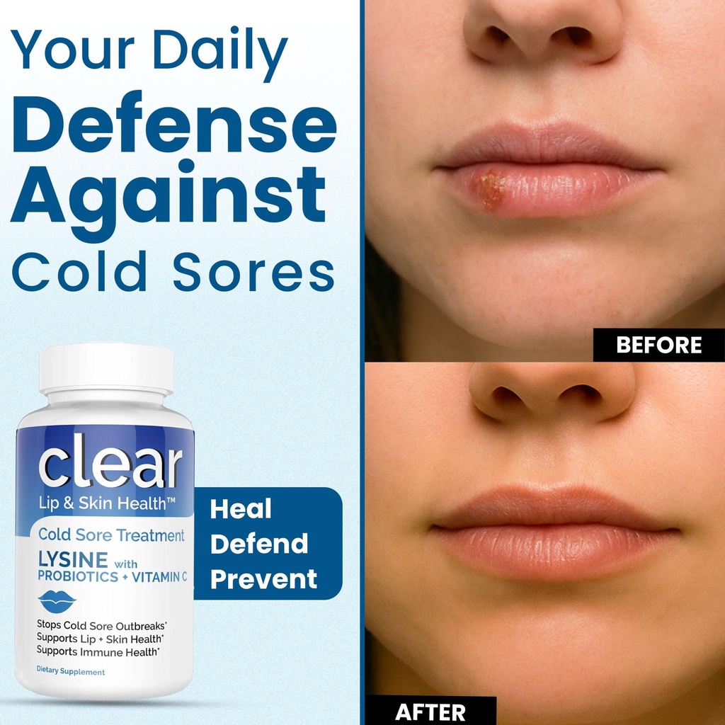clear-probiotics-lysine-cold-sore-treatm-5.jpg