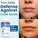 clear-probiotics-lysine-cold-sore-treatm-5.jpg