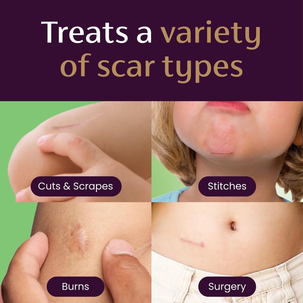 mederma-scar-gel-for-kids-reduces-the-ap-5.jpg