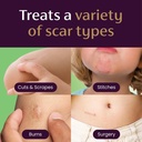 mederma-scar-gel-for-kids-reduces-the-ap-5.jpg