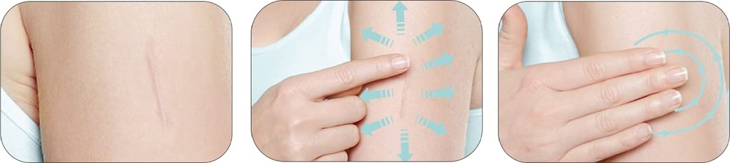 mederma-skin-care-helps-scars-surgery-in-3.jpg
