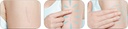 mederma-skin-care-helps-scars-surgery-in-3.jpg