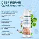 mitgary-advanced-scar-gel-silicone-scar--6.jpg