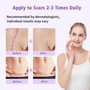 medical-grade-silicone-scar-gel-advanced-5.jpg