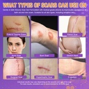 advanced-scar-gel-silicone-scar-gel-for--3.jpg