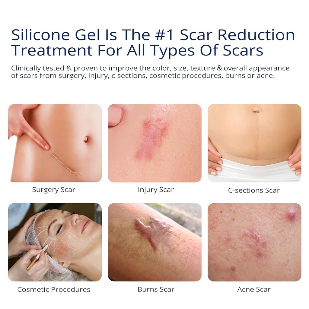100-silicone-scar-gel-scars-cream-advanc-2.jpg