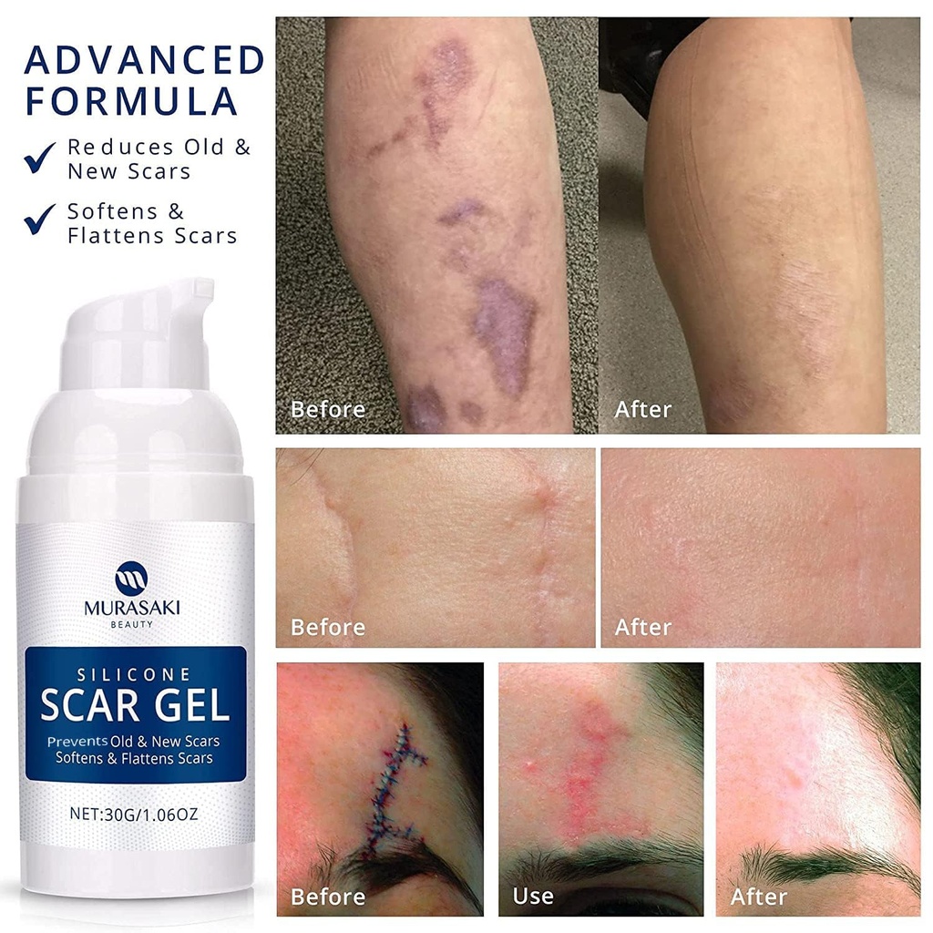 100-silicone-scar-gel-scars-cream-advanc-3.jpg