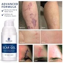 100-silicone-scar-gel-scars-cream-advanc-3.jpg