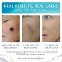 advanced-high-potency-silicone-scar-gel--3.jpg