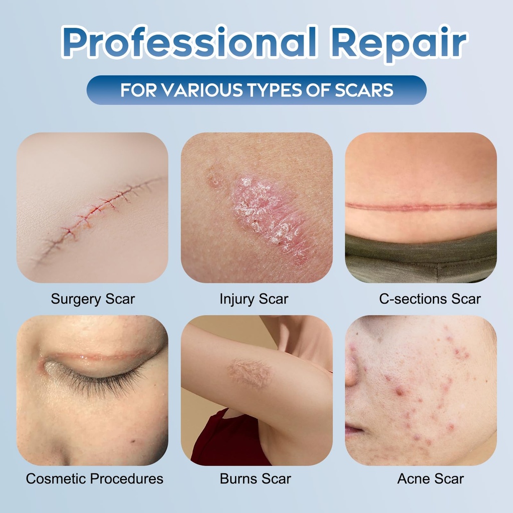 advanced-silicone-scar-gel-for-face-body-2.jpg