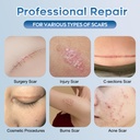 advanced-silicone-scar-gel-for-face-body-2.jpg