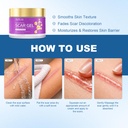 scar-cream-silicone-scar-gel-helps-reduc-3.jpg