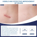 scar-cream-silicone-scar-gel-helps-reduc-5.jpg