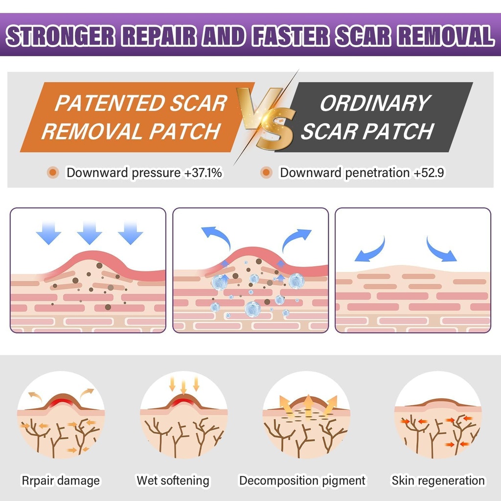 silicone-scar-sheets-medical-grade-silic-3.jpg