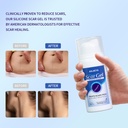 silicone-scar-gel-advanced-scar-cream-fo-4.jpg