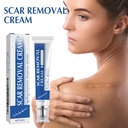 scar-cream-scar-removal-cream-silicone-s-2.jpg