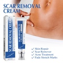 scar-cream-silicone-scar-gel-scar-remova-3.jpg