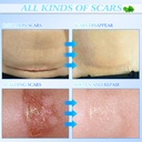 2pcs-scar-cream-for-men-and-women-face-b-6.jpg