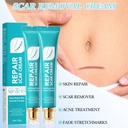 2pcs-scar-cream-for-men-and-women-face-b-5.jpg