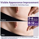 silicone-scar-sheets-silicone-scar-tape--3.jpg