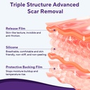silicone-scar-sheets-silicone-scar-tape--5.jpg