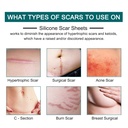 silicone-scar-sheets-1-6-x-120-roll-3m-s-2.jpg