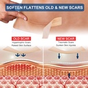 silicone-scar-sheets-1-6-x-120-roll-3m-s-3.jpg