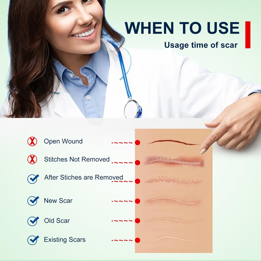 silicone-scar-sheets-1-6-x-120-roll-3m-s-5.jpg