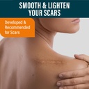 nuvadermis-scar-care-bundle-advanced-sca-4.jpg