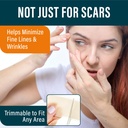nuvadermis-scar-care-bundle-advanced-sca-6.jpg