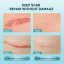 scar-gel-scar-cream-advance-scar-gel-for-3.jpg