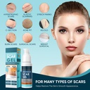 scar-gel-scar-cream-advance-scar-gel-for-2.jpg