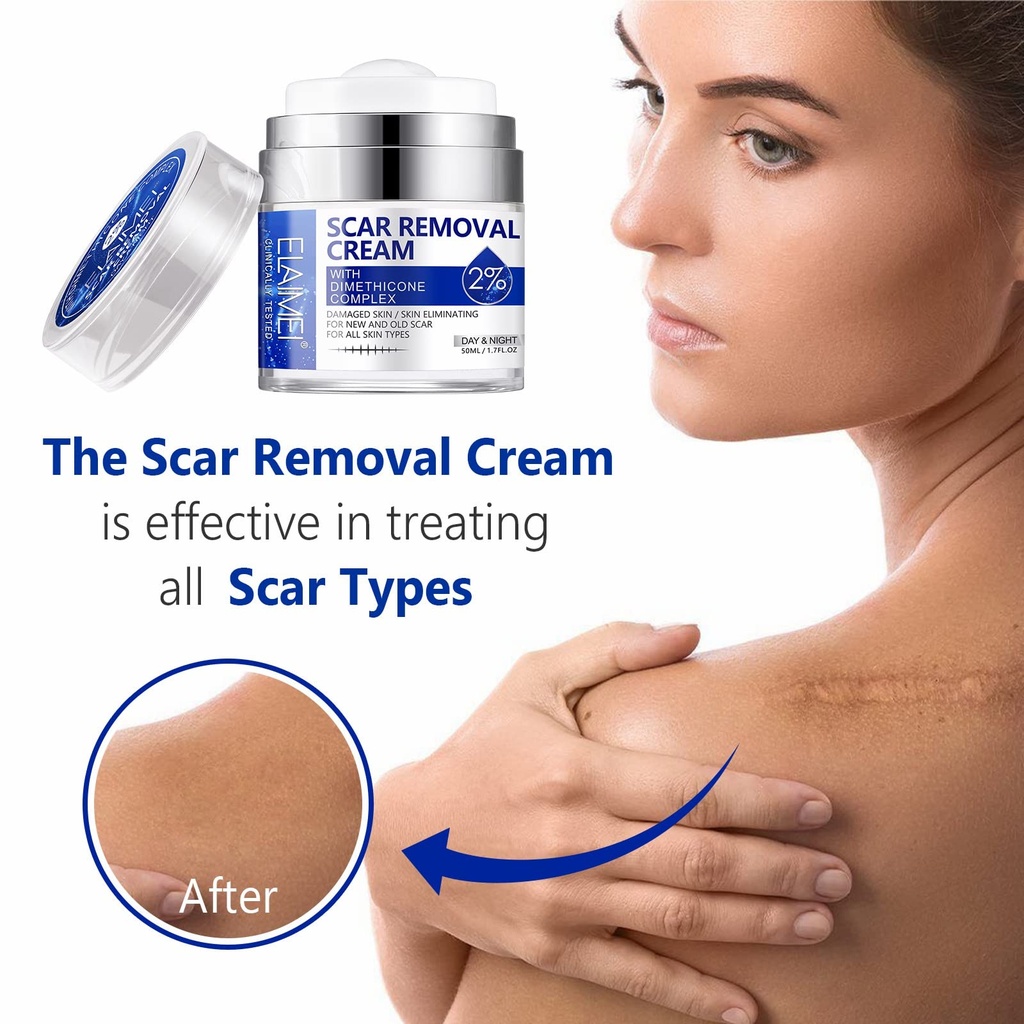 scar-cream-scar-removal-cream-advanced-s-5.jpg