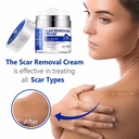 scar-cream-scar-removal-cream-advanced-s-5.jpg
