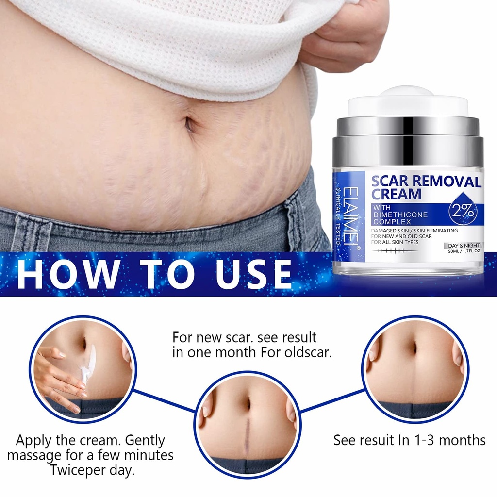 scar-cream-scar-removal-cream-advanced-s-6.jpg