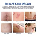 scar-cream-scar-removal-cream-advanced-s-3.jpg
